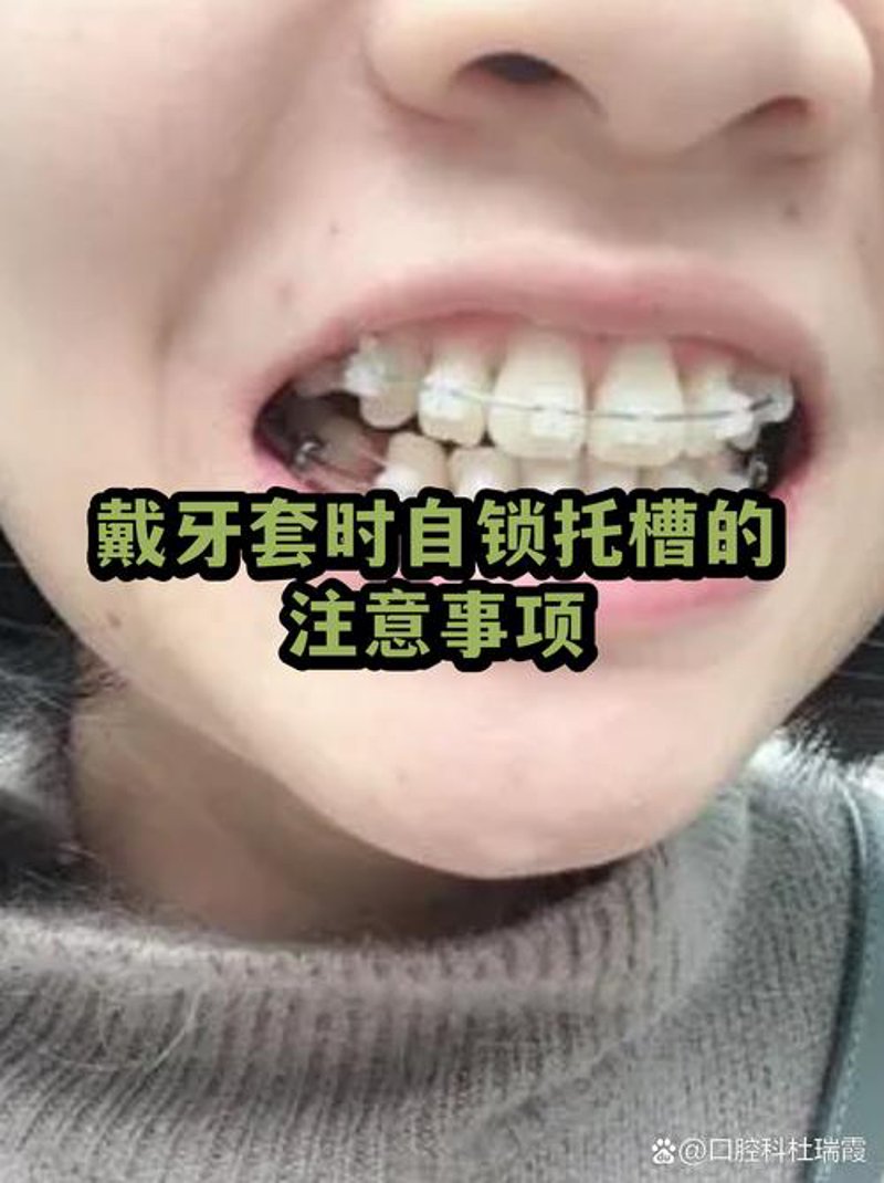 警惕牙科误区,护好每一颗牙齿