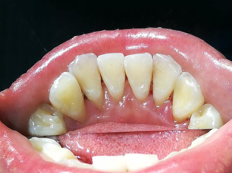 昭通牙科:守护口腔健康的新风向